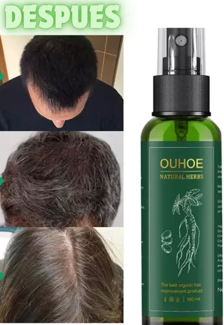 🌿 Spray para Crecer tu Cabello OUHOE ✨ X2