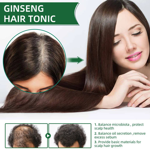 🌿 Spray para Crecer tu Cabello OUHOE ✨ X2